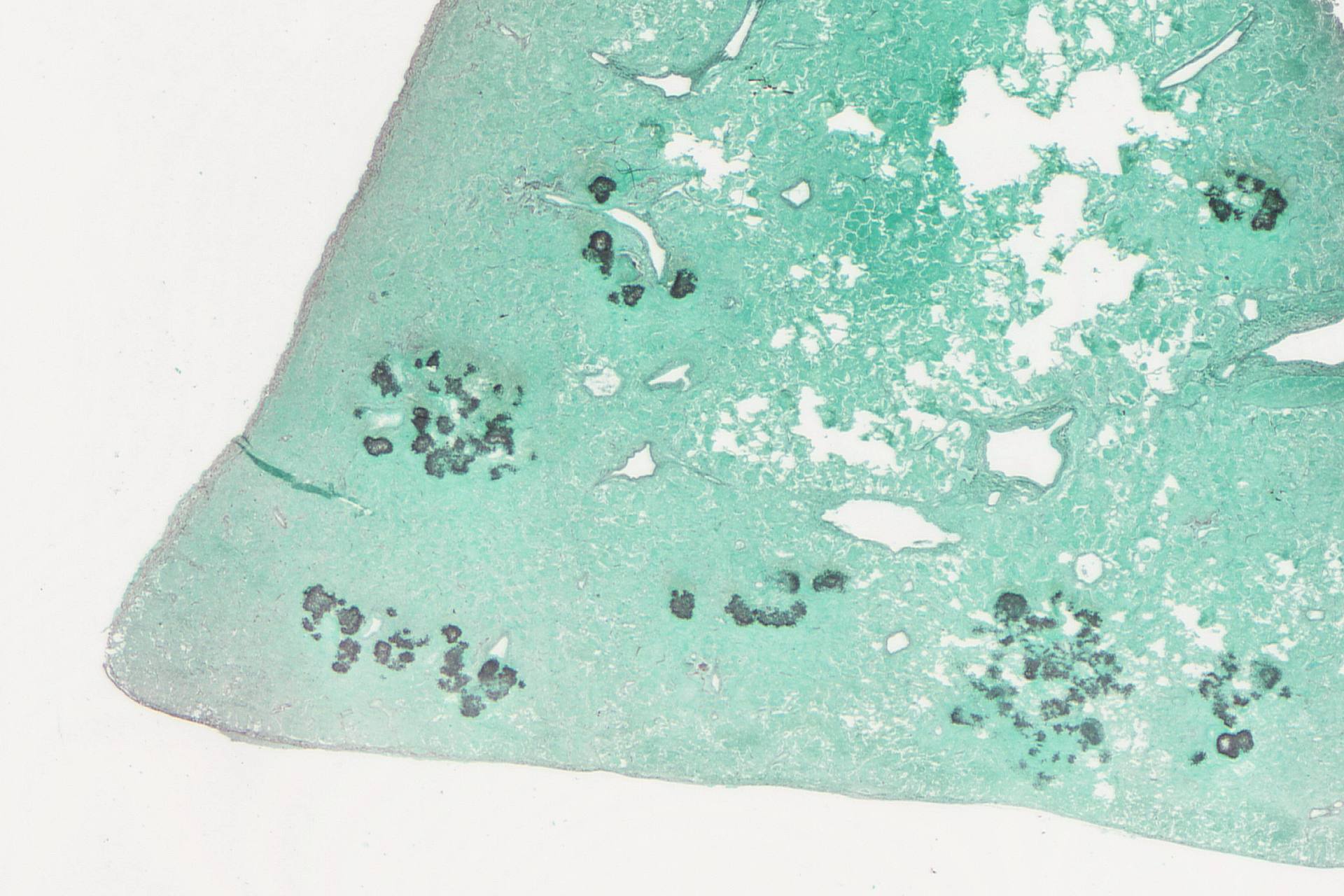 Objektträger in Grocott Färbung für Pilzsporen-Nachweis, Lungengewebe