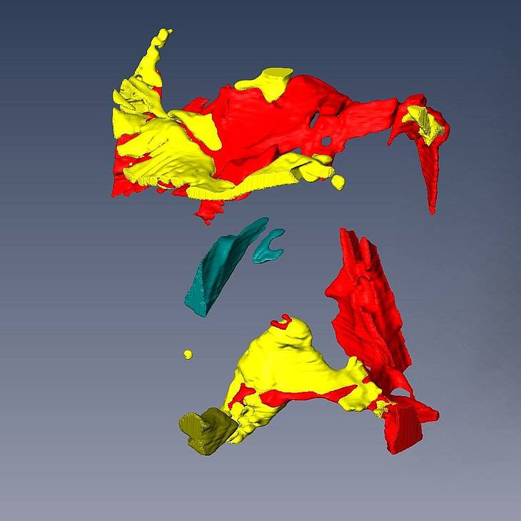 3D Visualisierung der unterschiedlichen Phasen der Aluminium-Silizium Legierung: Vergleich des 3D Modells gewonnen mittels FIB-Tomographie und CT.
