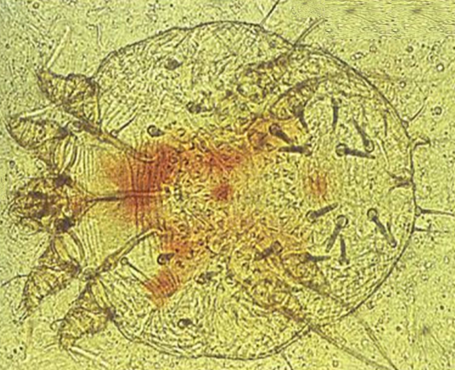 Der Erreger Sarcoptes scabiei var. hominis unter dem Mikroskop