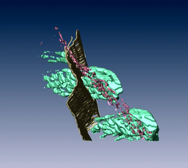 Rotierendes 3D Modell zeigt eine Stufe im Riss, an der sich eine Ausscheidung befindet.