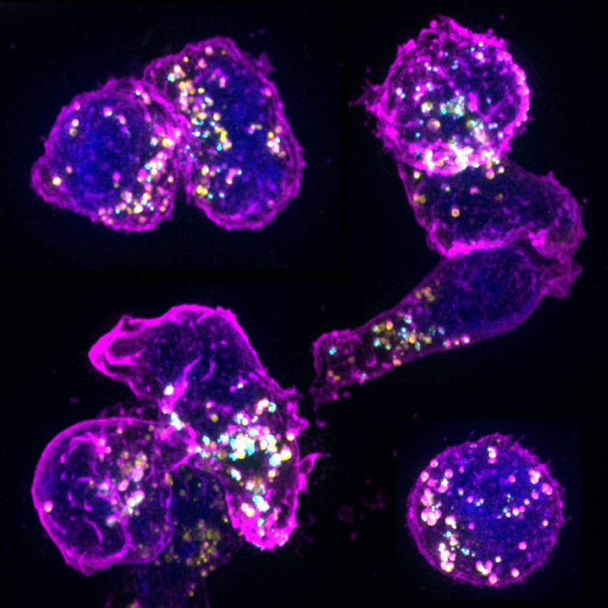 Abbildung von zytotoxischen T-Lymphozyten und ihren verschiedenen zytotoxischen Granula