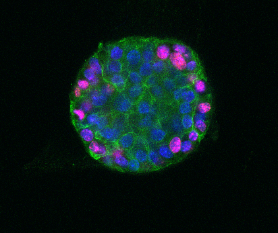 Lung organoid immunostained for Ki67 (magenta) and DAPI (nuclei)