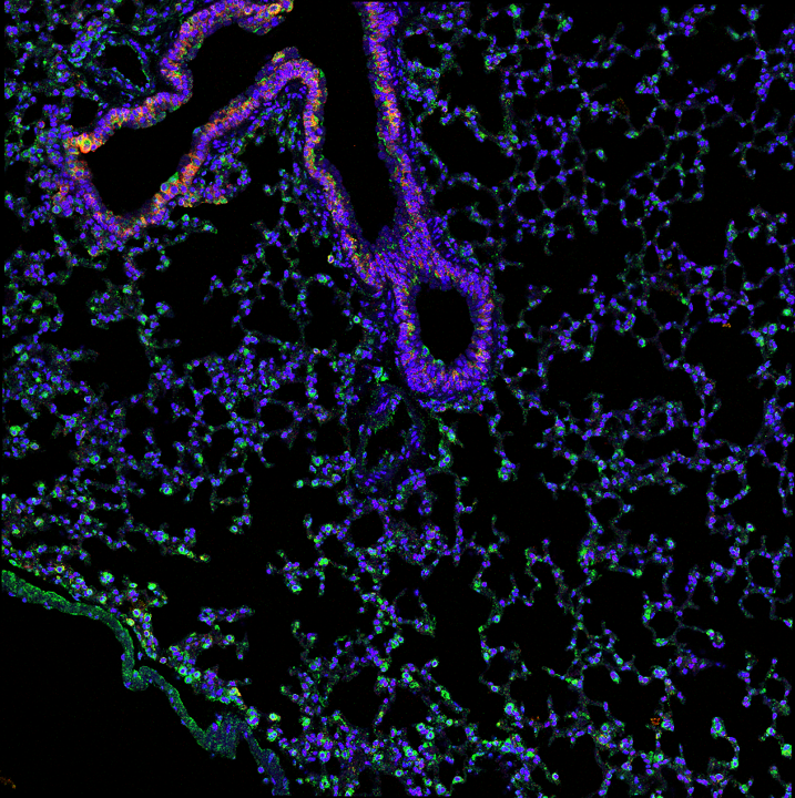 Immunostaining of Precision Cut Lung Slices (PCLS)