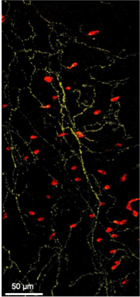 Sensory nerve fibers (yellow) innervating the tracheal mucosa closely associated with epithelial (tuft) cells (red)