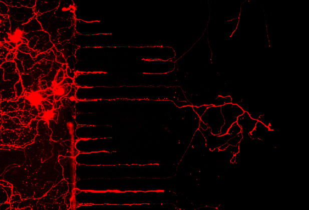 Fluorescently labelled intestinal neurons (projections)