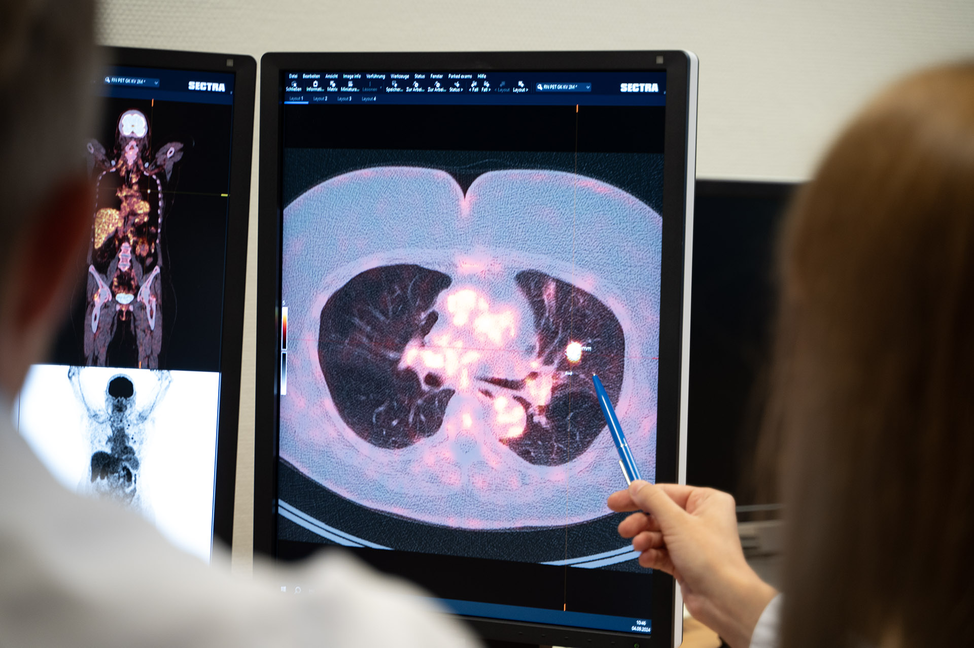 Zwei Mitarbeitende der Klinik für Nuklearmedizin sitzen an einem PC-Arbeitsplatz und besprechen gemeinsam den PET-Befund eines Patienten.
