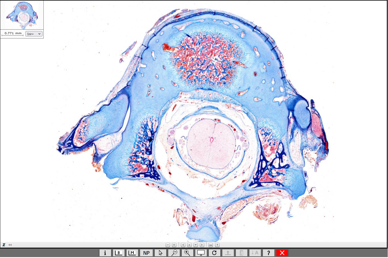 Knochenentwicklung Wirbel (Fetus, Mensch) Screenshot der virtuellen Mikroskopie der Universität des Saarlandes